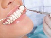 Протезирование зубов: современные технологии в стоматологи