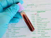 Подготовка к анализу крови для всех возрастов