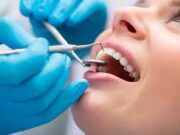 Современные методы лечения зубов без боли