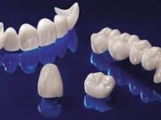 Почему выбирают циркониевую зубную коронку?