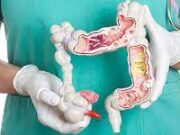 Как готовиться к колоноскопии кишечника под наркозом?