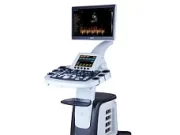 Современные УЗИ аппараты: преимущества ультразвуковых сканеров нового поколения