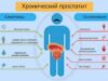 Как определить, есть ли у меня простатит?