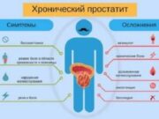 Как определить, есть ли у меня простатит?