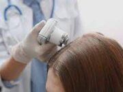 Диагностика заболеваний волос