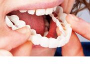 Уход за керамическими коронками и винирами