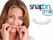 Виниры Snap on Smile: мгновенно преображают любые проблемные зубы