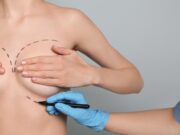 Пластика груди