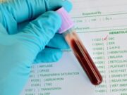 Когда нужно сдавать клинический анализ крови?