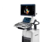 Чем отличается стационарный УЗИ-аппарат?