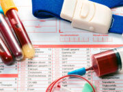 Что можно и нельзя перед общим анализом крови?