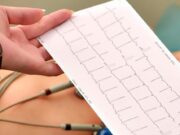 Преимущества проведения ЭКГ на дому