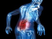 Защемление нерва в пояснице: симптомы и лечение