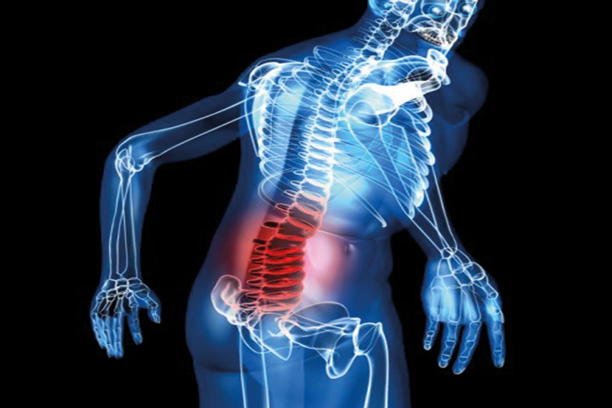 Седалищный нерв анатомия таз. Воспаление седалищного нерва. Ишиас седалищного нерва. Заземление седалищный нерв. Пояснично седалищный нерв.