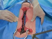 Заболевания позвоночника: оперативное решение проблем