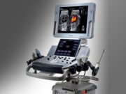 Что могут современные аппараты УЗИ?