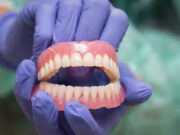 Этапы протезирования зубов в стоматологической клинике