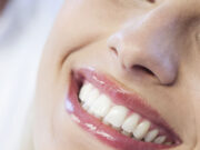 Преимущества лечения зубов в клинике DentaGuard