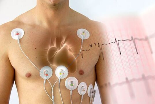 Холтеровское мониторирование: проверьте здоровье сердца и сосудов