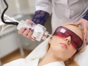 Лазерное омоложение лица в клинике КС