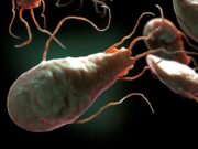 Причины возникновения лямблиоза