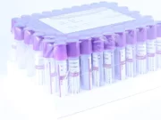 Вакуумные пробирки с ЭДТА: вакутейнеры для гематологических исследований