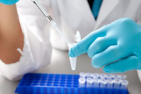 Какие анализы нужно сдать на скрытые инфекции?