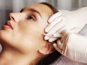 С какими проблемами справляется биоревитализация?