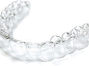 Почему элайнеры необходимо менять так часто?