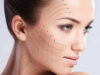 Лифтинг лица: как выбрать оптимальный вариант?