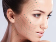 Лифтинг лица: как выбрать оптимальный вариант?