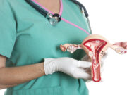 Конизация шейки матки: как проходит операция?