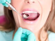 Показания к установке пломбы на зуб