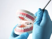 Комплексный подход к лечению кариеса: психологический аспект в работе стоматологов СПб