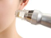 RF лифтинг: что это за процедура и как она работает?