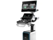 Новая система визуализации Mindray Consona N9