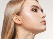 Фейслифтинг: пластическая операция по круговой подтяжке лица