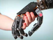 Виды протезов верхних конечностей