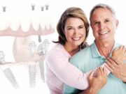 Рекомендации по уходу и поддержке после процедуры all on 4 имплантации под ключ