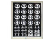 Классификация негатоскопов