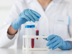 ДНК-тесты и генетические анализы здоровья