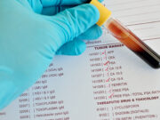 Анализ на онкомаркеры и анализ HE4: важные инструменты в диагностике онкологических заболеваний