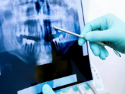 Методы диагностики в стоматологии