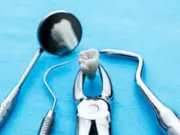 Рекомендации по приему пищи после удаления зуба от стоматологов клиники АО «Медицина»