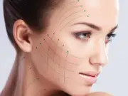 Нитевой лифтинг лица: идеально подходит для профилактики и коррекции небольших возрастных изменений