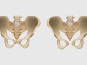 Симфизит: почему болит лобковая кость и что с этим делать