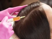 Плазмотерапия волос в Москве: что это, как работает и стоит ли идти